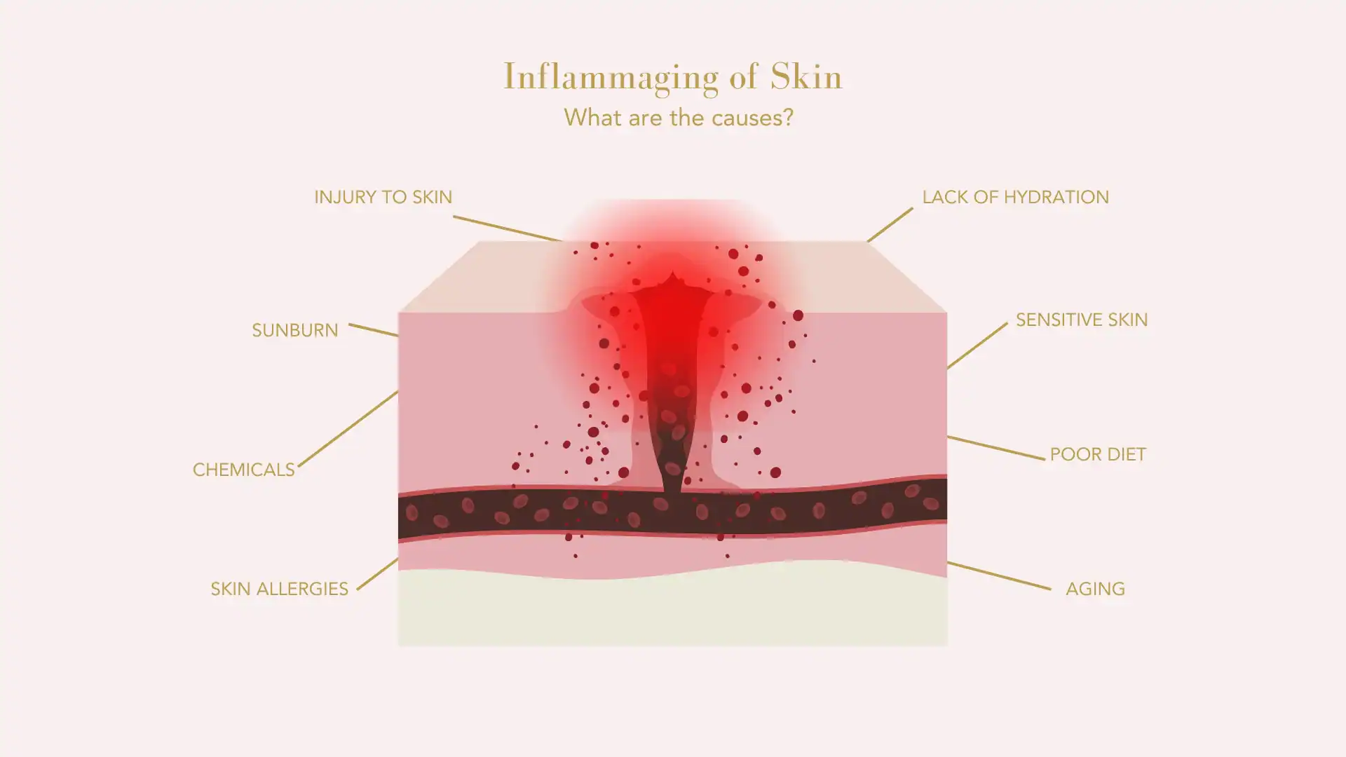 Inflammaging of Skin: What are the Causes?